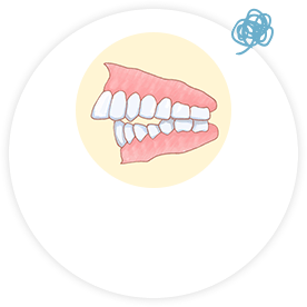 前歯が出ている