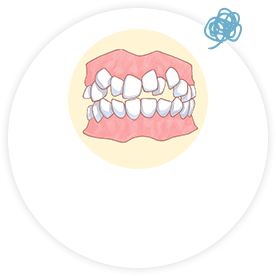 歯がデコボコしている…